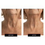 CurrentBody Skin LED Neck & Décolletage Mask