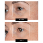 CurrentBody Skin LED Eye Perfector & 5 Eye Hydrogel Masks (worth £224)